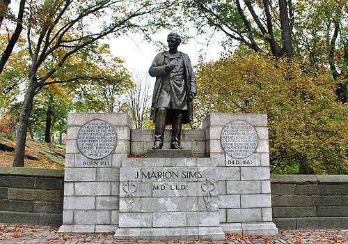 j marion sims